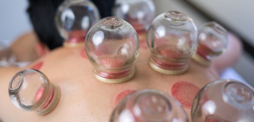 Formation Pose de ventouses (bases) FORMATION POUVANT ETRE ADMISE EN FORMATION CONTINUE PAR ASCA/RME